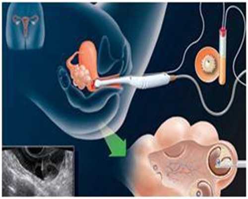 代孕产子的过程和方式_多久才能测出代孕