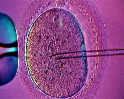 代孕网-试管婴儿取卵代孕-正常胎儿脑室会分离吗