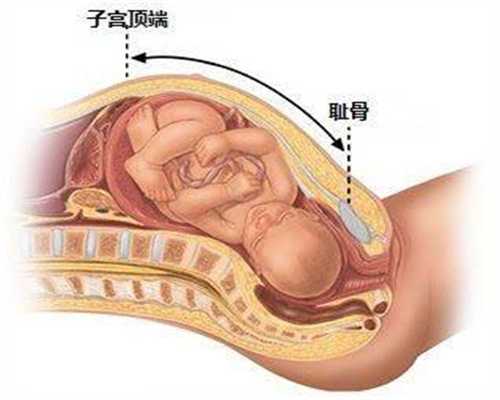 代孕靠谱吗-武汉三代试管包生男孩_面对泰国试管出现的并发症，如何预防