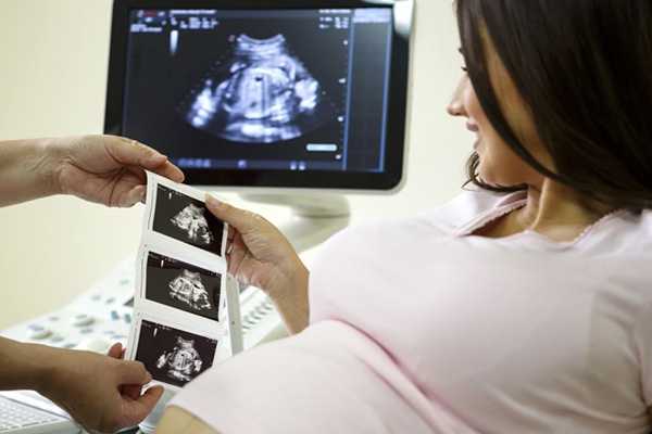 在武汉协和医院做试管婴儿移植两个优胚着床成功率高吗？